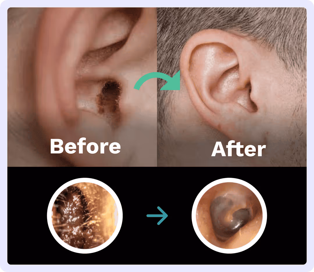 Before and after ear examination views following suitable earwax removal
